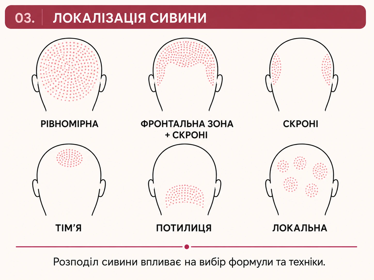 Шість варіантів локалізації сивини